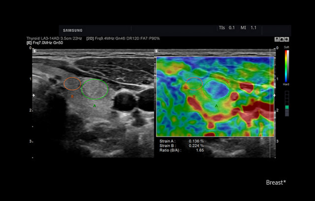ízületi ultrahang nyíregyháza fáj a csípőízület jobb oldalán